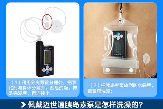 迈世通胰岛素泵洗澡